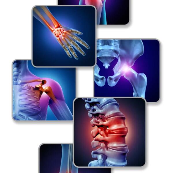 Human Joint Pain